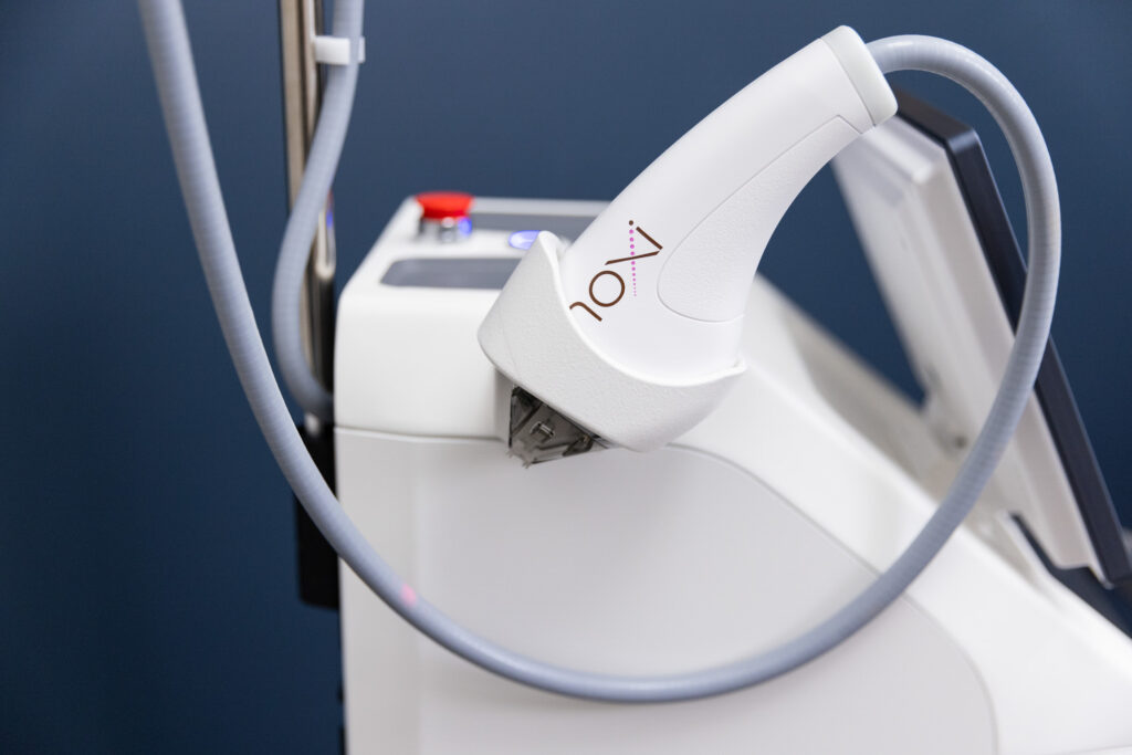 A shot of the Moxi laser for scars in Elgin