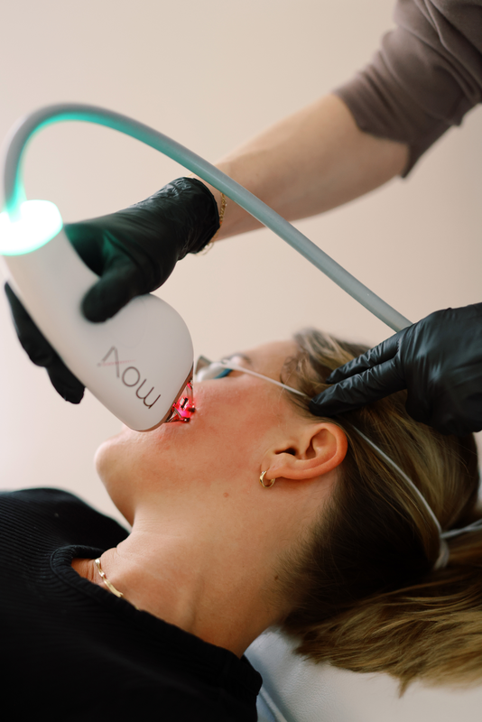 Moxi Laser