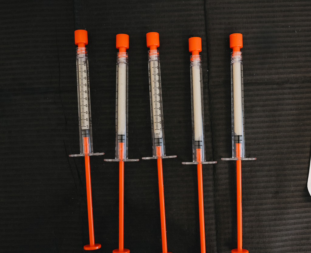 Platelet-Rich Plasma (PRP)